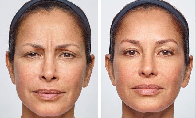 second-face