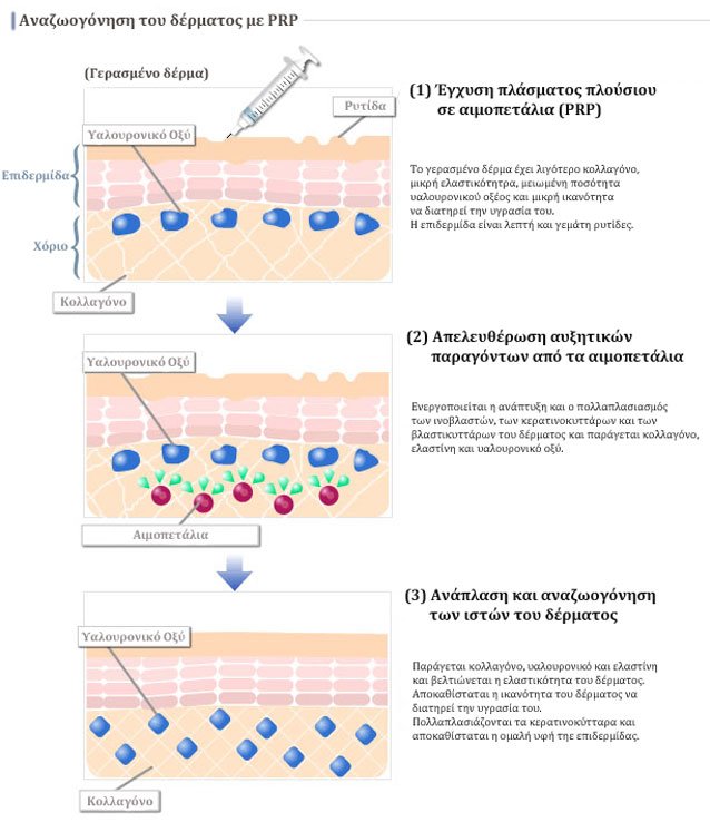 autologi-meso8erapia_new-1