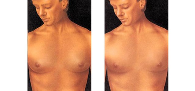 before-and-after