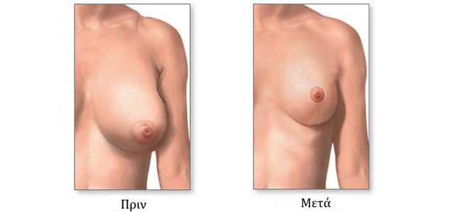 before-and-after