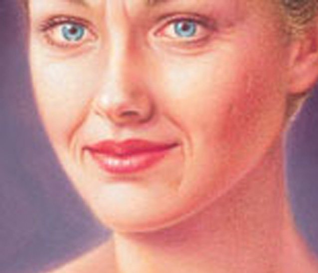fat_transfer_face--new-02