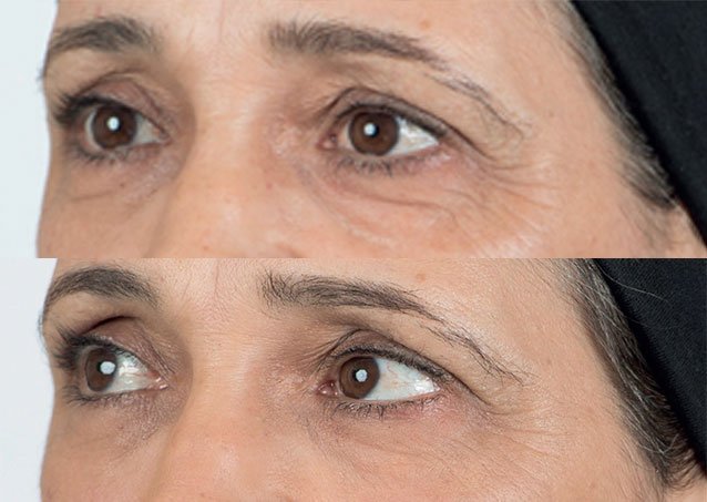 granny-eyes