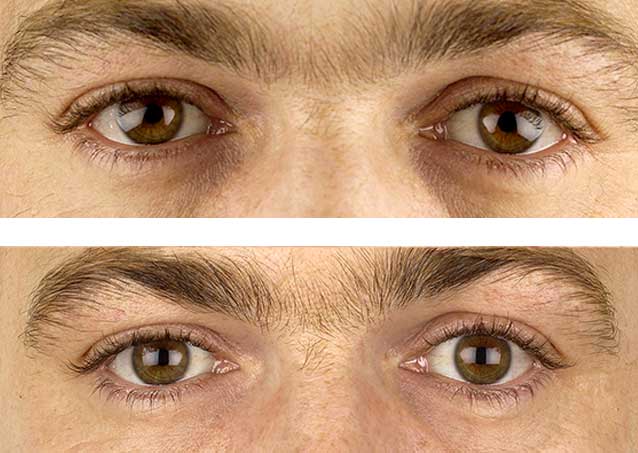 man-eyes