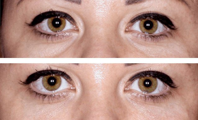 other-eyes